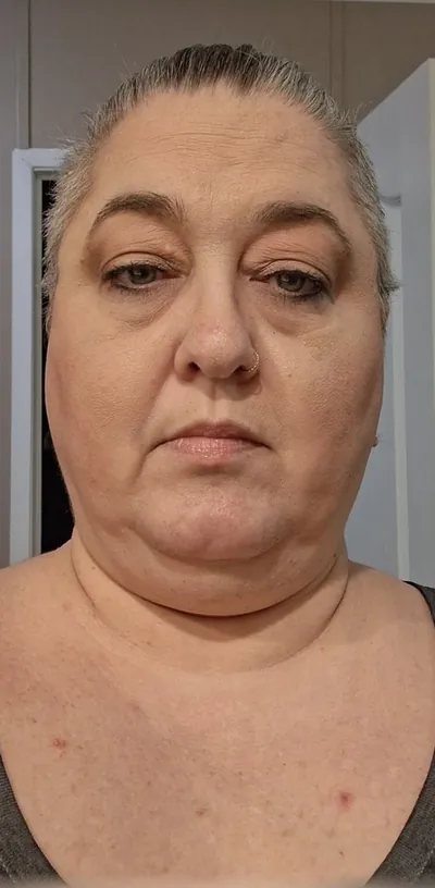 Amanda W. before